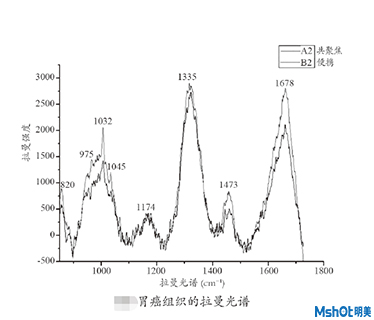 拉曼光譜技術(shù)在生物醫(yī)學中的應用
